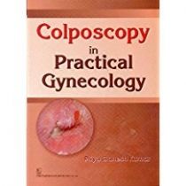 Colposcopy In Practical Gynecology
