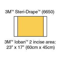 3M Ioban Antimicrobial Incise Drapes 6650, Box of 10
