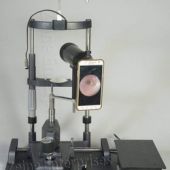 Mydriatric Fundus Camera without Mobile Phone