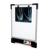 X-ray Film Viewer Single - LED based with Dimmer(NR)