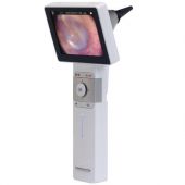 Horus scope Digital Video Otoscope with in-built screen & Rechargeable Handle