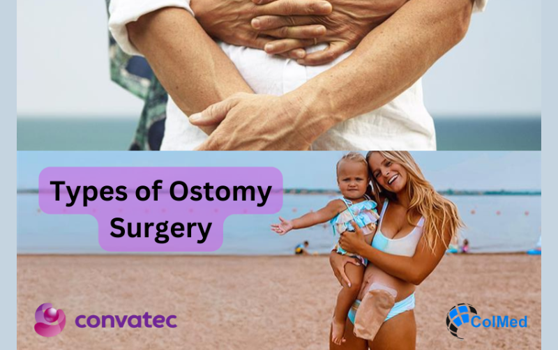 Types of Ostomy Surgery
