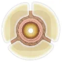 79402-adapt-hollister-ostomyBarrier-extendersonabarrier__24409.webp