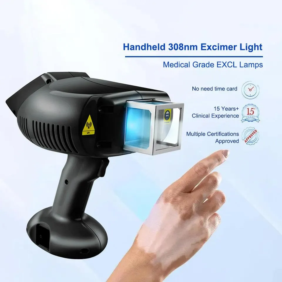 UVThera Pro 308nm Excimer Laser System
 — Professional XeCl Excimer Lamp for Vitiligo, Psoriasis & Eczema | Clinical-Grade Targeted UVB Phototherapy Device for Dermatology Clinics