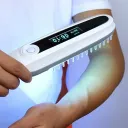UVThera 311nm UVB Wand— Comb-Style Phototherapy Lamp for Vitiligo & Psoriasis | 48cm² Wide Coverage, OLED Digital Timer, Home Use